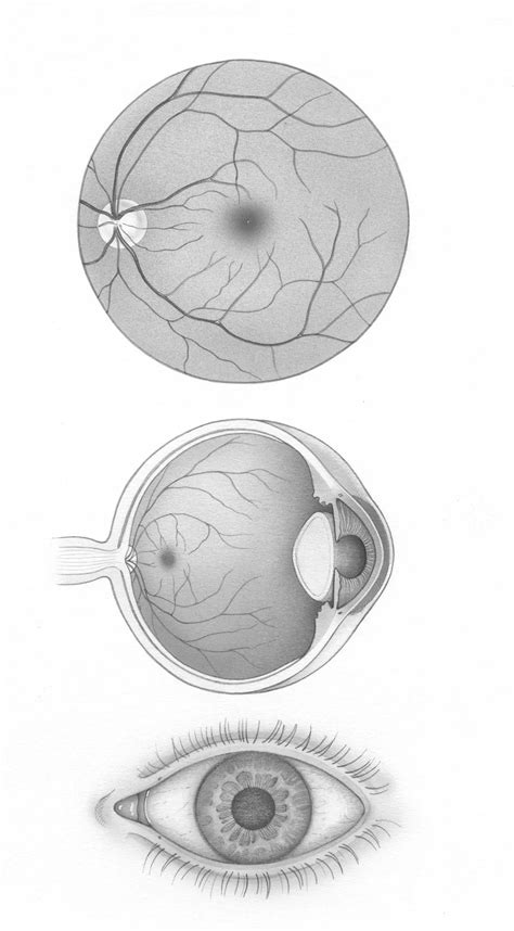 Eye Sketch Pad American Academy Of Ophthalmology