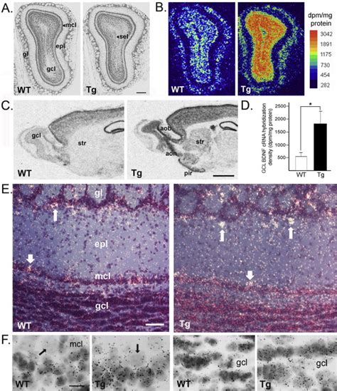 Bdnf Over Expression Increases Olfactory Bulb Granule Cell Dendritic