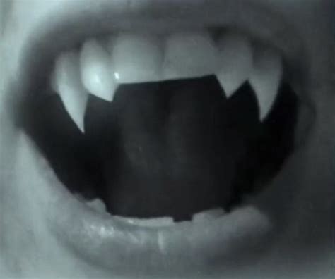 Not Mine Werewolf Aesthetic Vampire Teeth Teeth Aesthetic