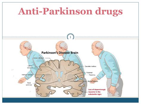 Solution Pharmacology Of Anti Parkinson Drugs Studypool