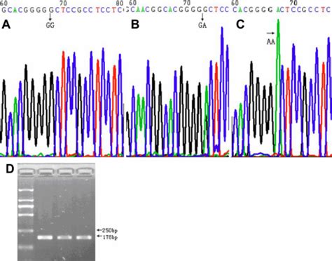 Representative Chromatograms Displaying And The Pcr Electrophoresis