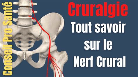 Th Orie Sciatique Tout Savoir Sur Cette Pathologie Quest Ce Que Le