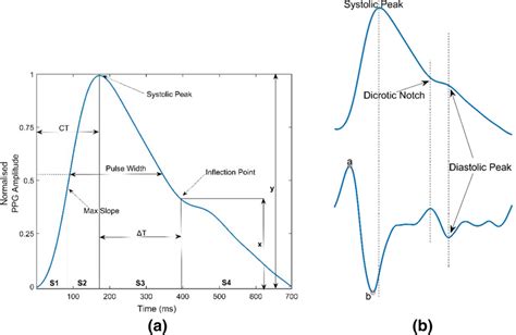 A A PPG Signal With Labelled Features Adapted From Kachuee Et Al