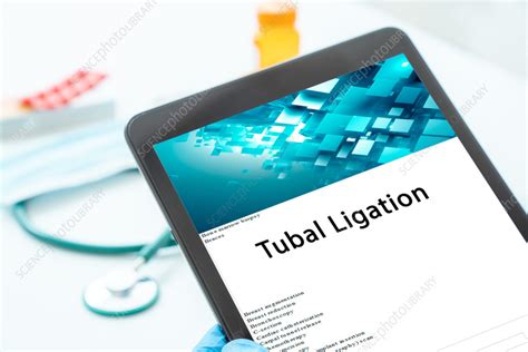 Tubal Ligation Stock Image F0420355 Science Photo Library