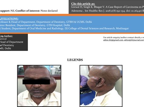 Figure 1 From A Case Report Of Carcinoma Ex Pleomorphic Adenoma Semantic Scholar