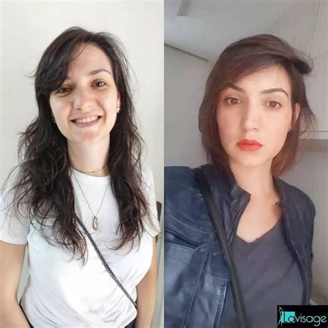 Pin On Antes E Depois