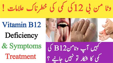 Vitamin B Deficiency Symptoms How To Increase Vitamin B Vitamin