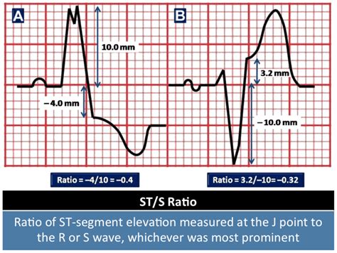 Pearls From Resusx Rewired 2020 Rebel Em Emergency Medicine Blog