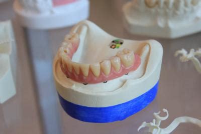 Easy Ways To Remove Denture Adhesive European Denture