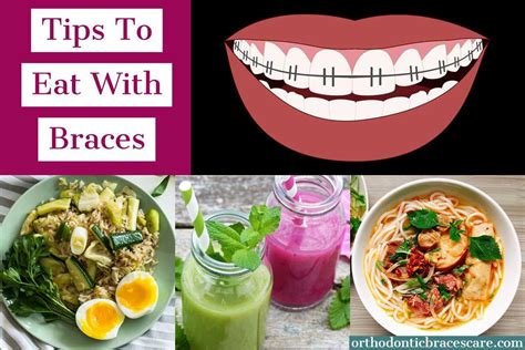 How To Eat And Chew With Braces [top 19 Simple Tips] Orthodontic Braces Care Soft Foods To