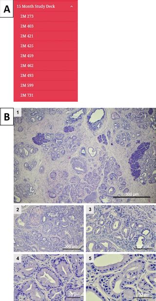 The Mouse Model Of Pancreatic Cancer Atlas Mmpca For Classification Of Pancreatic Cancer