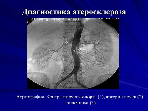 Заболевания сердечно-сосудистой системы. Атеросклероз - презентация онлайн