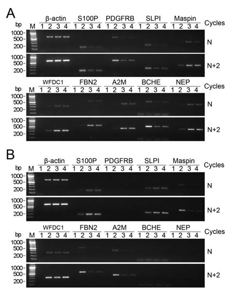 Rt Pcr Identification Of Differential Gene Expression Induced By Download Scientific Diagram