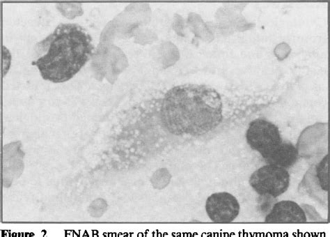 Figure 2 From A Comparison Between The Cytological And Histological