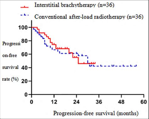 Progression Free Survival Curve Of Interstitial Brachytherapy And