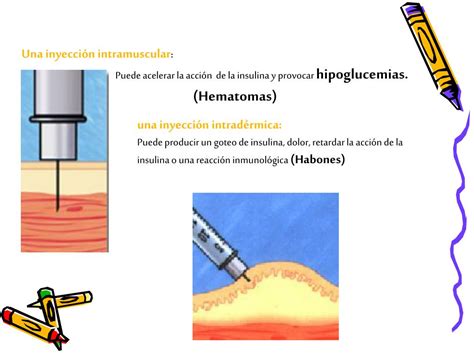 Ppt Taller De Administracion De Insulina Powerpoint Presentation Free Download Id 857394