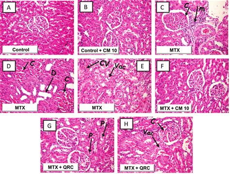 Camel Milk Alleviates Methotrexate Induced Renal Histopathological