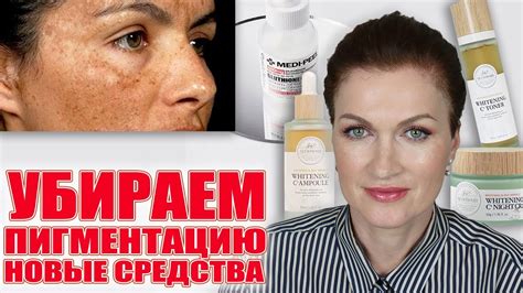 Пигментация? Решаемо! - YouTube