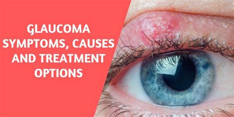 Glaucoma Symptoms Causes Diagnosis Treatment Savali