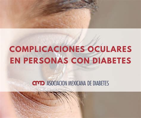 Complicaciones Oculares En Personas Con Diabetes