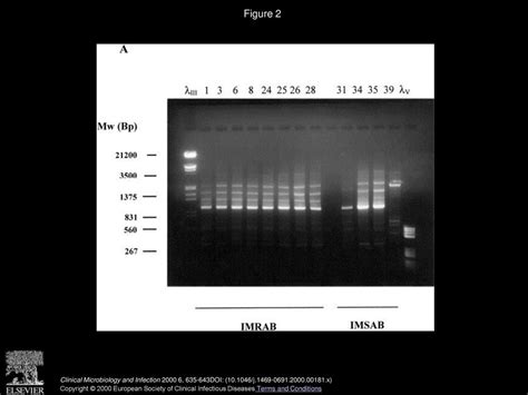 PCR Based DNA Fingerprinting REP PCR AP PCR And Pulsed Field Gel