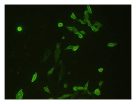 Immunofluorescence Staining On Cd133 U251 Stem Like Cell Spheres And