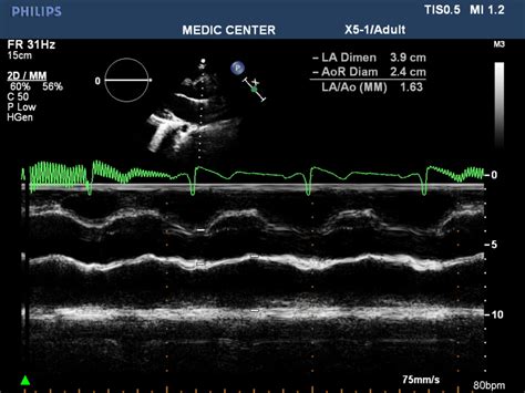 PDA 1b - DocCheck