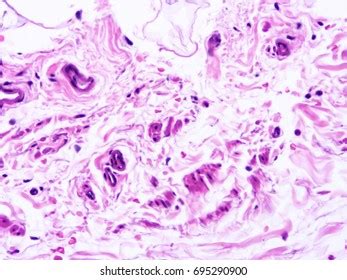 Epididymides Images, Stock Photos & Vectors | Shutterstock