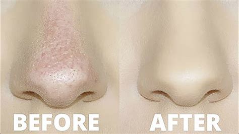 How To Stop Foundation Rubbing Off Your Nose Oily Skin Tricks Youtube