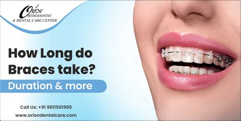 How Long Do Braces Take Duration More Orion Dental Care