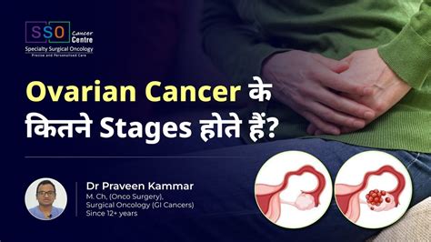 Ovarian Cancer के कितने Stages होते हैं From Stage 1 To Advanced