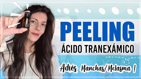 Peeling Cido Tranex Mico Demostraci N Peeling Activos Kit Y