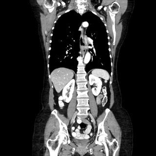 Cross Sectional Computed Tomography Imaging Of The Abdomen And Pelvis