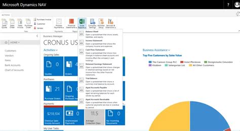 Microsoft Dynamics Nav Navision Erp Support Saglobal