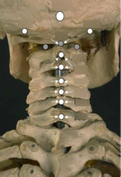 Posterior Cervical Counterstrain Diagram Quizlet