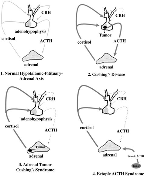 Physiopathological Changes In Cortisol Secretion Download Scientific