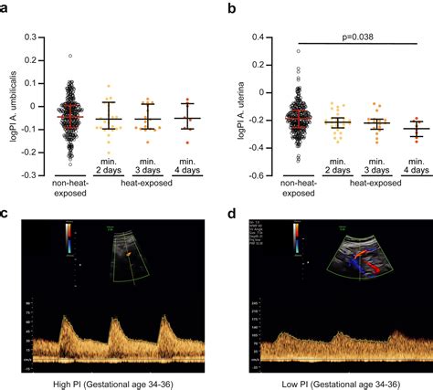 Increased Late Preterm Birth Risk And Altered Uterine Blood Flow Upon