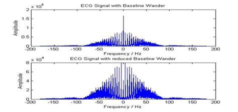 Frequency Domain Representation Fft Of Ecg Baseline Wander