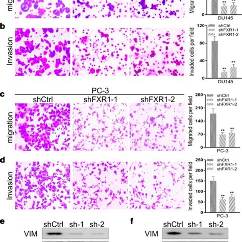 Fxr Silencing Reduces Prostate Cancer Cell Migration And Invasion