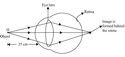 Human Eye Practically Study Material