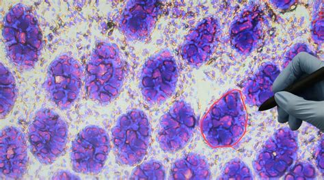 High-precision Laser Microdissection System 