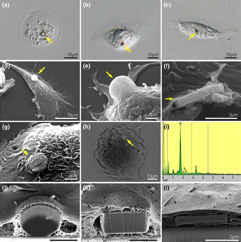 Phagocytosis Of Microparticles By Macrophages A C Bright Field