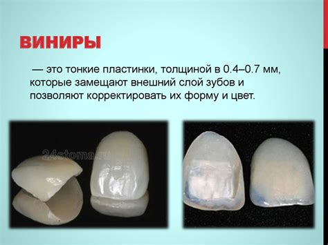Виниры. Показания - презентация онлайн