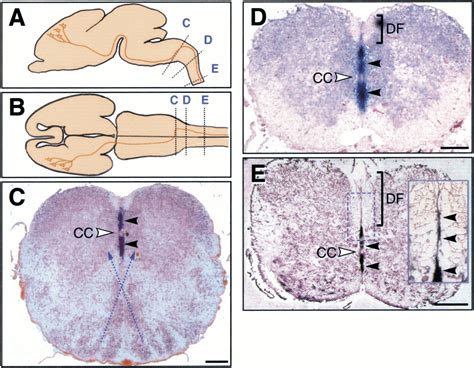 Ephrin B3 Is The Midline Barrier That Prevents Corticospinal Tract