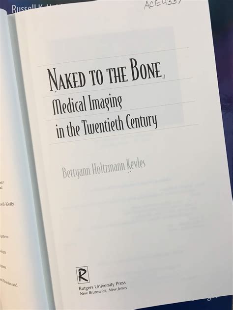 Intermediate Physics For Medicine And Biology Naked To The Bone