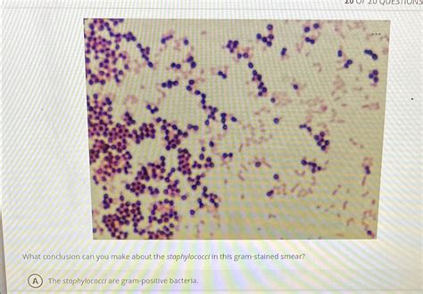 Solved What Conclusion Can You Make About The Staphylococci