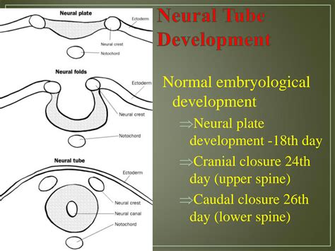 SOLUTION: Neural tube defects - Studypool