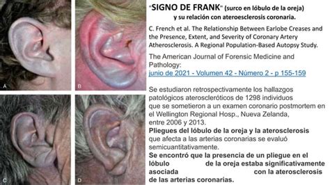 Signo De Frank Pptx