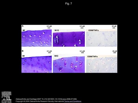 Mmp And Non Mmp Mediated Release Of Aggrecan And Its Fragments From