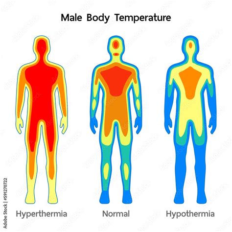 Body Heat Diagram